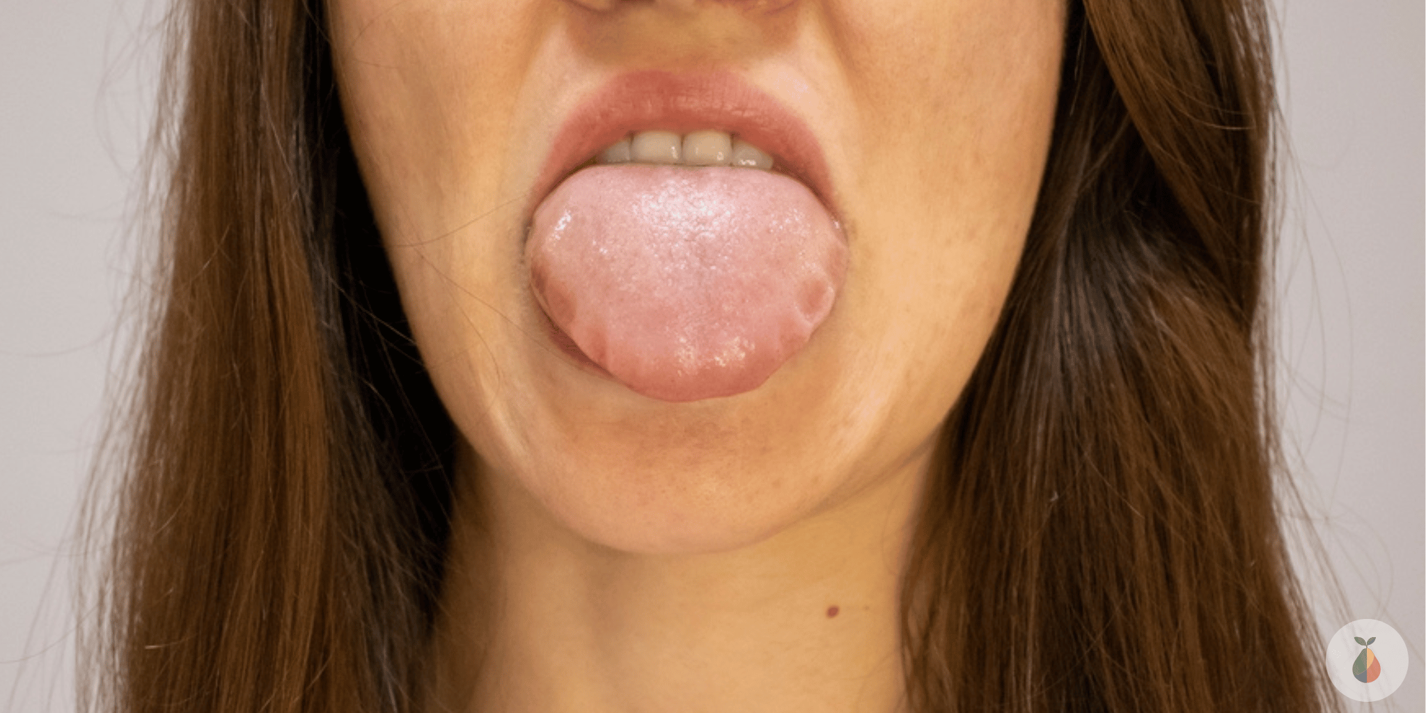 Real-Life Anaphylaxis Cases – Why Allergy Awareness Matters